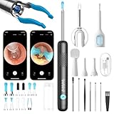 BEBIRD R1 Ultra Ohrenschmalz Entferner Kamera, Ohrenreiniger mit Otoskop f&uuml;r Zuhause, Komplett-Set mit Sichtbarer Dropper & Pinzette, F&uuml;r Ohr & Nase & Rachen Untersuchung der Familie-Schwarze